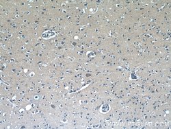 RAB3GAP1 Rabbit anti-Human, Mouse, Rat, Polyclonal, Proteintech 150 &mu;L;