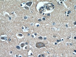 RAB3GAP1 Rabbit anti-Human, Mouse, Rat, Polyclonal, Proteintech 150 &mu;L;