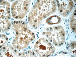 RAB3GAP1 Rabbit anti-Human, Mouse, Rat, Polyclonal, Proteintech 150 &mu;L;