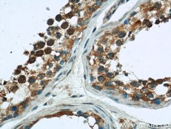 RAB3GAP1 Rabbit anti-Human, Mouse, Rat, Polyclonal, Proteintech 150 &mu;L;