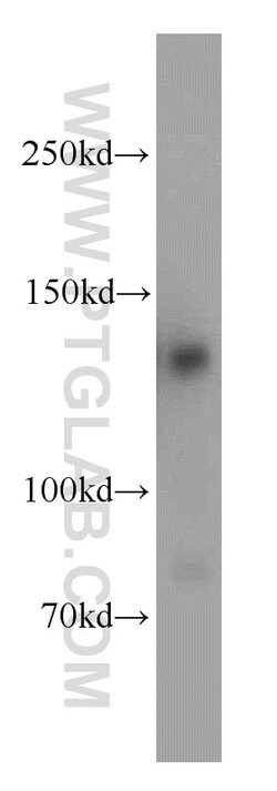 RAB3GAP1 Rabbit anti-Human, Mouse, Rat, Polyclonal, Proteintech 150 &mu;L;
