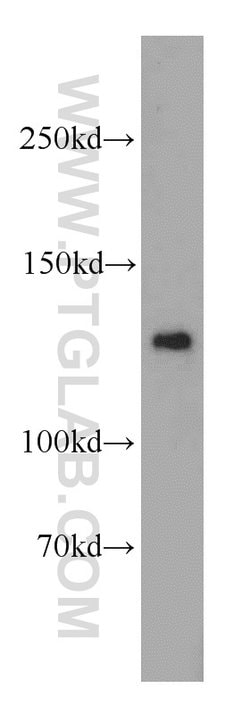 RAB3GAP1 Rabbit anti-Human, Mouse, Rat, Polyclonal, Proteintech 150 &mu;L;