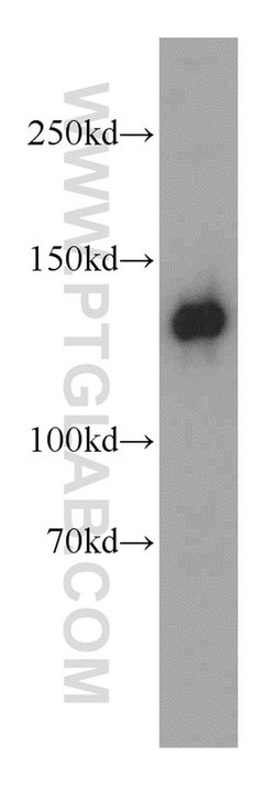 RAB3GAP1 Rabbit anti-Human, Mouse, Rat, Polyclonal, Proteintech 150 &mu;L;
