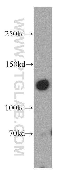 RAB3GAP1 Rabbit anti-Human, Mouse, Rat, Polyclonal, Proteintech 150 &mu;L;