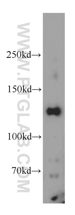 RAB3GAP1 Rabbit anti-Human, Mouse, Rat, Polyclonal, Proteintech 150 &mu;L;