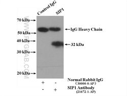 SIP1 Rabbit anti-Human, Mouse, Rat, Polyclonal, Proteintech:Antibodies:Primary