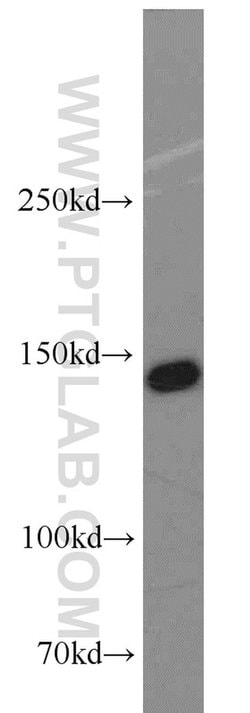 SMC1A Rabbit anti-Human, Mouse, Polyclonal, Proteintech 20 &mu;L; Unconjugated:Antibodies,