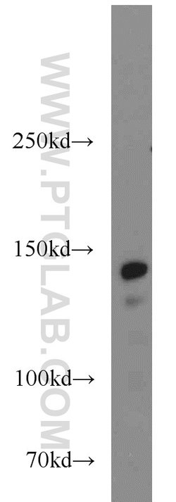 SMC1A Rabbit anti-Human, Mouse, Polyclonal, Proteintech 20 &mu;L; Unconjugated:Antibodies,