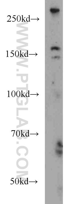 ODZ1 Rabbit anti-Human, Mouse, Polyclonal, Proteintech:Antibodies:Primary