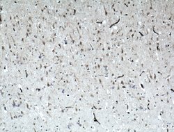 ODZ1 Rabbit anti-Human, Mouse, Polyclonal, Proteintech:Antibodies:Primary