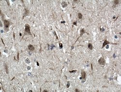 ODZ1 Rabbit anti-Human, Mouse, Polyclonal, Proteintech:Antibodies:Primary