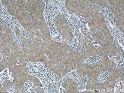 NEDD4 Rabbit anti-Human, Mouse, Non-human primate, Rat, Polyclonal, Proteintech