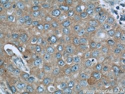 NEDD4 Rabbit anti-Human, Mouse, Non-human primate, Rat, Polyclonal, Proteintech