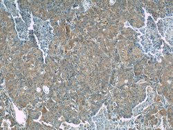 NEDD4 Rabbit anti-Human, Mouse, Non-human primate, Rat, Polyclonal, Proteintech