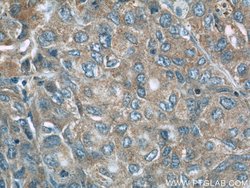 NEDD4 Rabbit anti-Human, Mouse, Non-human primate, Rat, Polyclonal, Proteintech