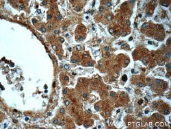 NEDD4 Rabbit anti-Human, Mouse, Non-human primate, Rat, Polyclonal, Proteintech