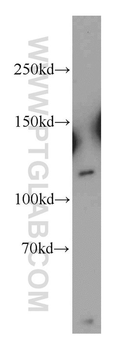 NEDD4 Rabbit anti-Human, Mouse, Non-human primate, Rat, Polyclonal, Proteintech