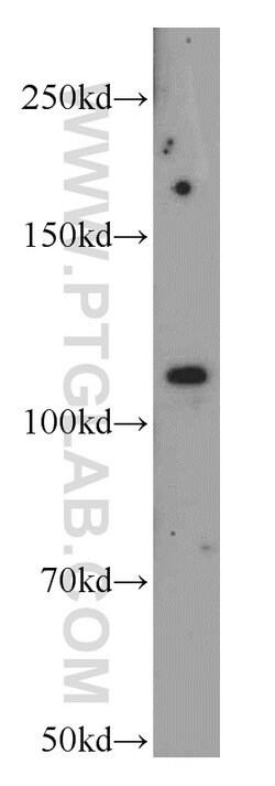 NEDD4 Rabbit anti-Human, Mouse, Non-human primate, Rat, Polyclonal, Proteintech