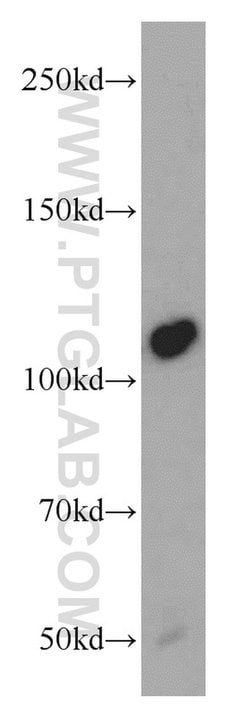 NEDD4 Rabbit anti-Human, Mouse, Non-human primate, Rat, Polyclonal, Proteintech