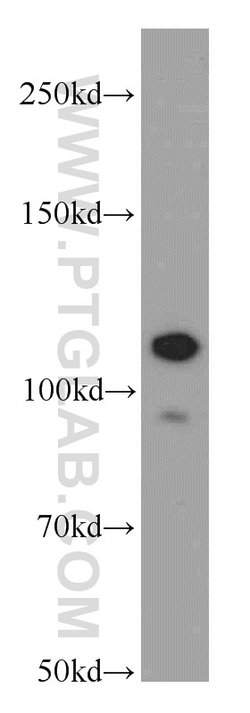 NEDD4 Rabbit anti-Human, Mouse, Non-human primate, Rat, Polyclonal, Proteintech