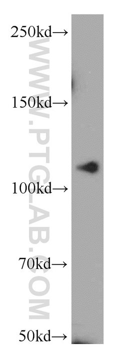 NEDD4 Rabbit anti-Human, Mouse, Non-human primate, Rat, Polyclonal, Proteintech