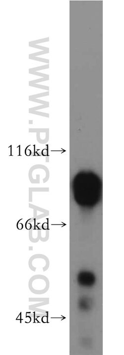 DCLK1 Rabbit anti-Human, Mouse, Rat, Polyclonal, Proteintech:Antibodies:Primary