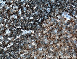 HLA-DMB Rabbit anti-Human, Polyclonal, Proteintech 150 μL; Unconjugated:Antibodies,