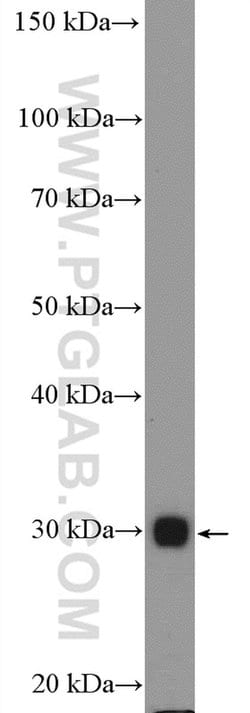 HLA-DMB Rabbit anti-Human, Polyclonal, Proteintech 150 μL; Unconjugated:Antibodies,