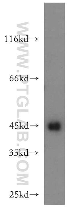 UQCRC1 Rabbit anti-Human, Mouse, Rat, Polyclonal, Proteintech:Antibodies:Primary