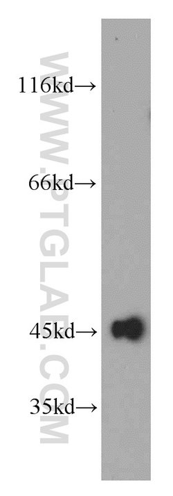 UQCRC1 Rabbit anti-Human, Mouse, Rat, Polyclonal, Proteintech:Antibodies:Primary