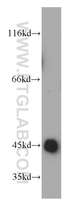 UQCRC1 Rabbit anti-Human, Mouse, Rat, Polyclonal, Proteintech:Antibodies:Primary