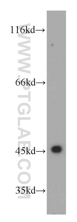 UQCRC1 Rabbit anti-Human, Mouse, Rat, Polyclonal, Proteintech:Antibodies:Primary