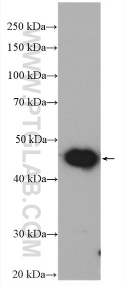 UQCRC1 Rabbit anti-Human, Mouse, Rat, Polyclonal, Proteintech:Antibodies:Primary