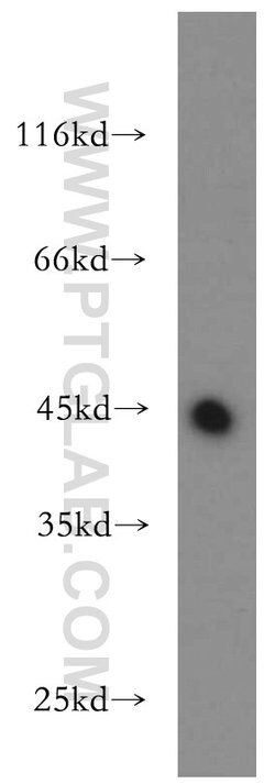 UQCRC1 Rabbit anti-Human, Mouse, Rat, Polyclonal, Proteintech:Antibodies:Primary