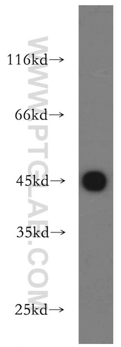 UQCRC1 Rabbit anti-Human, Mouse, Rat, Polyclonal, Proteintech:Antibodies:Primary