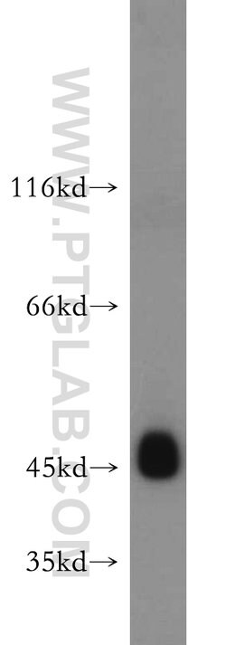UQCRC1 Rabbit anti-Human, Mouse, Rat, Polyclonal, Proteintech:Antibodies:Primary