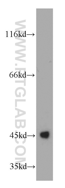UQCRC1 Rabbit anti-Human, Mouse, Rat, Polyclonal, Proteintech:Antibodies:Primary