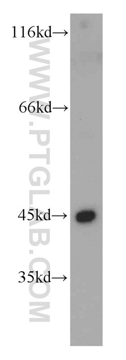 UQCRC1 Rabbit anti-Human, Mouse, Rat, Polyclonal, Proteintech:Antibodies:Primary