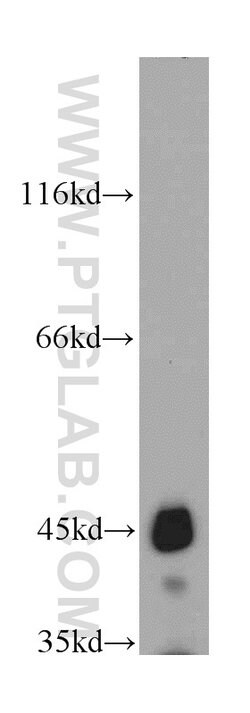 UQCRC1 Rabbit anti-Human, Mouse, Rat, Polyclonal, Proteintech:Antibodies:Primary