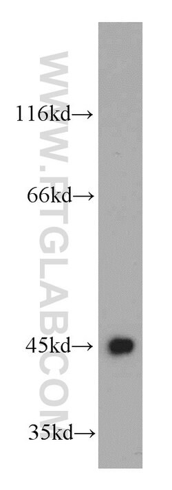 UQCRC1 Rabbit anti-Human, Mouse, Rat, Polyclonal, Proteintech:Antibodies:Primary