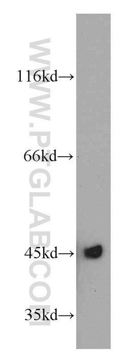 UQCRC1 Rabbit anti-Human, Mouse, Rat, Polyclonal, Proteintech:Antibodies:Primary