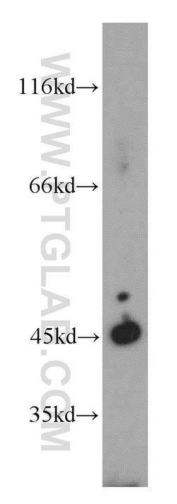 UQCRC1 Rabbit anti-Human, Mouse, Rat, Polyclonal, Proteintech:Antibodies:Primary