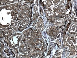 Thyroglobulin Rabbit anti-Human, Polyclonal, Proteintech 20 &mu;L; Unconjugated:Antibodies,