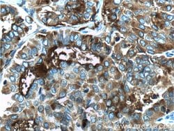 Thyroglobulin Rabbit anti-Human, Polyclonal, Proteintech 20 &mu;L; Unconjugated:Antibodies,