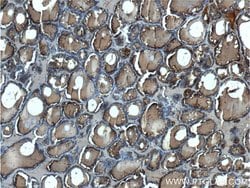 Thyroglobulin Rabbit anti-Human, Polyclonal, Proteintech 20 &mu;L; Unconjugated:Antibodies,