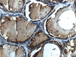 Thyroglobulin Rabbit anti-Human, Polyclonal, Proteintech 20 &mu;L; Unconjugated:Antibodies,