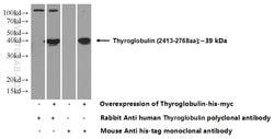 Thyroglobulin Rabbit anti-Human, Polyclonal, Proteintech 20 &mu;L; Unconjugated:Antibodies,