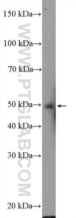 ZIC3 Rabbit anti-Human, Mouse, Polyclonal, Proteintech 150 &mu;L; Unconjugated:Antibodies,
