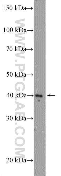ZIC3 Rabbit anti-Human, Mouse, Polyclonal, Proteintech 150 &mu;L; Unconjugated:Antibodies,