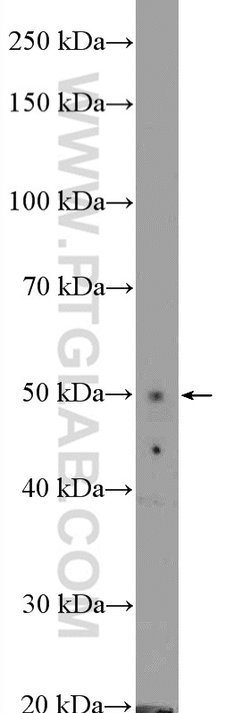 ZIC3 Rabbit anti-Human, Mouse, Polyclonal, Proteintech 150 &mu;L; Unconjugated:Antibodies,